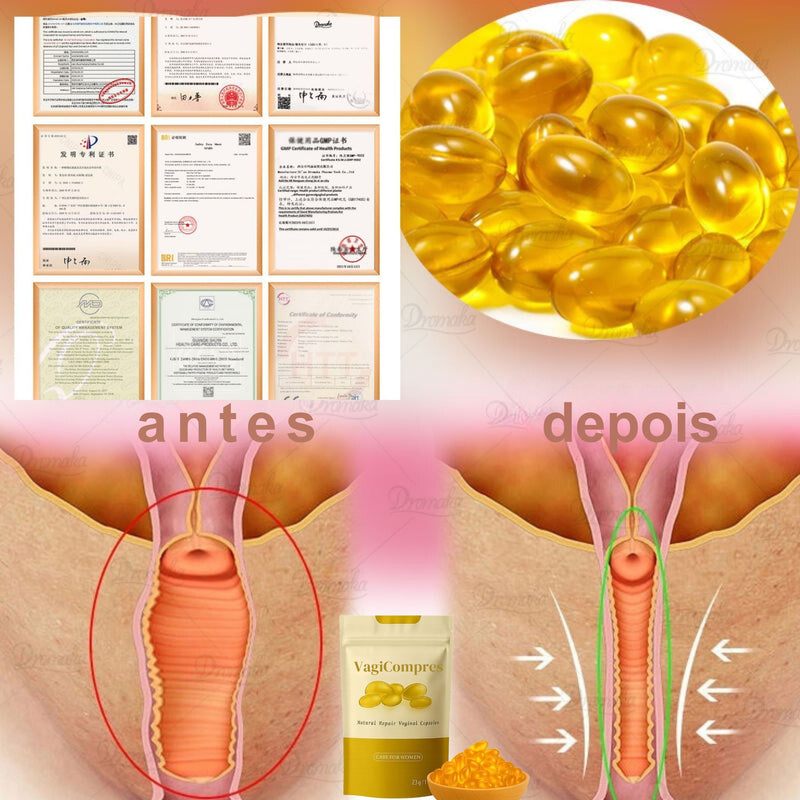 Acabe com o Ressecamento e a Flacidez Íntіmа еm Аté 14 Dіаѕ - VagiCompres 6 em 1