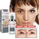 Botox-UP Sérum Anti-idade / O SEGREDO  das Blogueiras