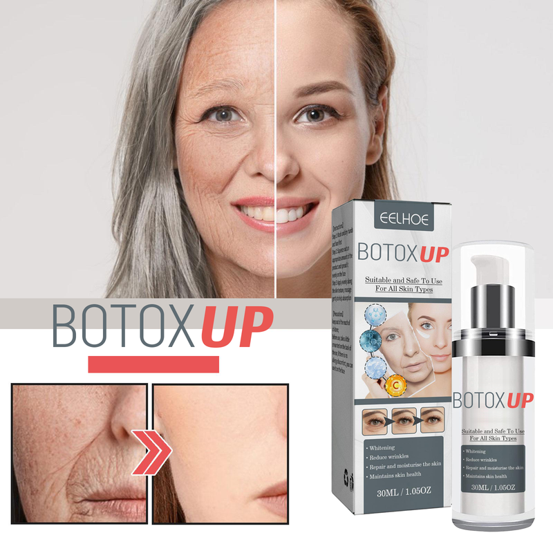 Botox-UP Sérum Anti-idade / O SEGREDO  das Blogueiras