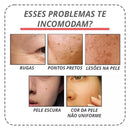Botox-UP Sérum Anti-idade / O SEGREDO  das Blogueiras